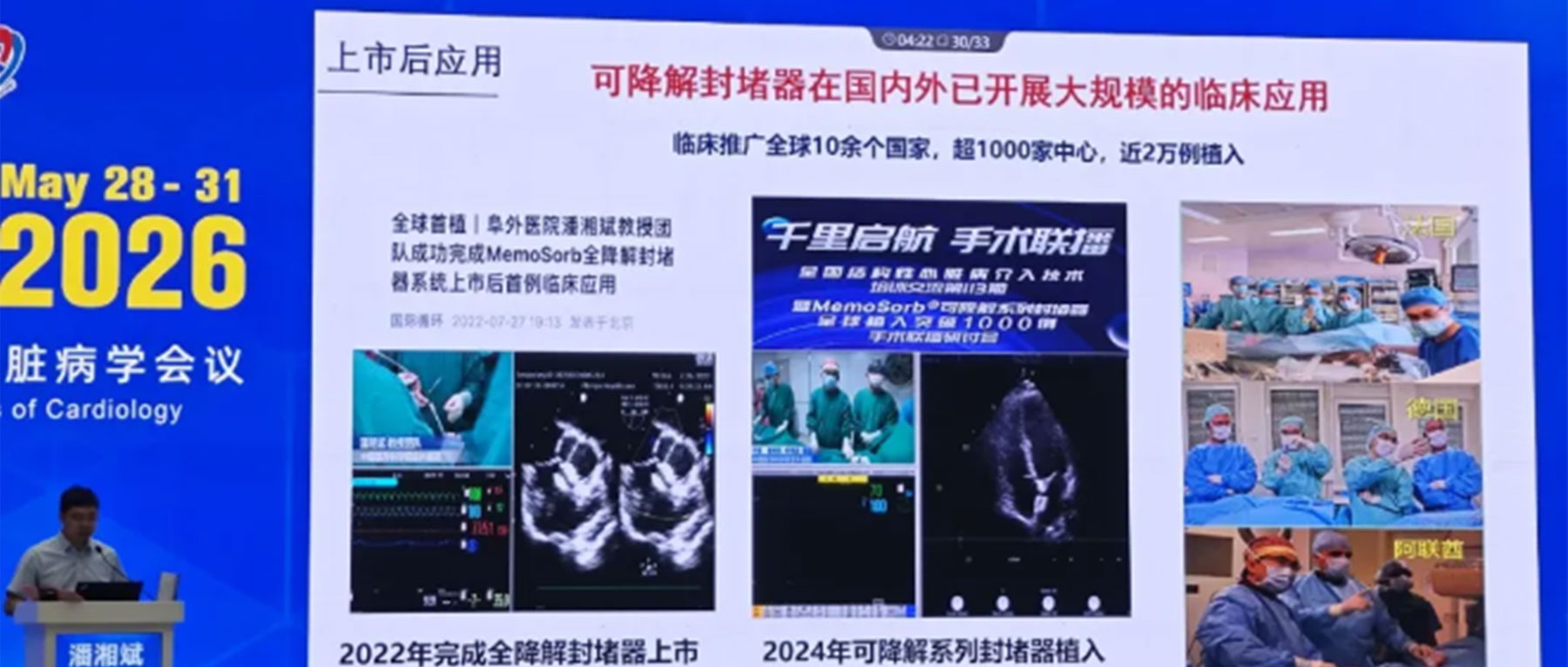 OCC2026盘点｜从中国原创MemoSorb体系看生物可降解封堵技术全球应用与未来路径