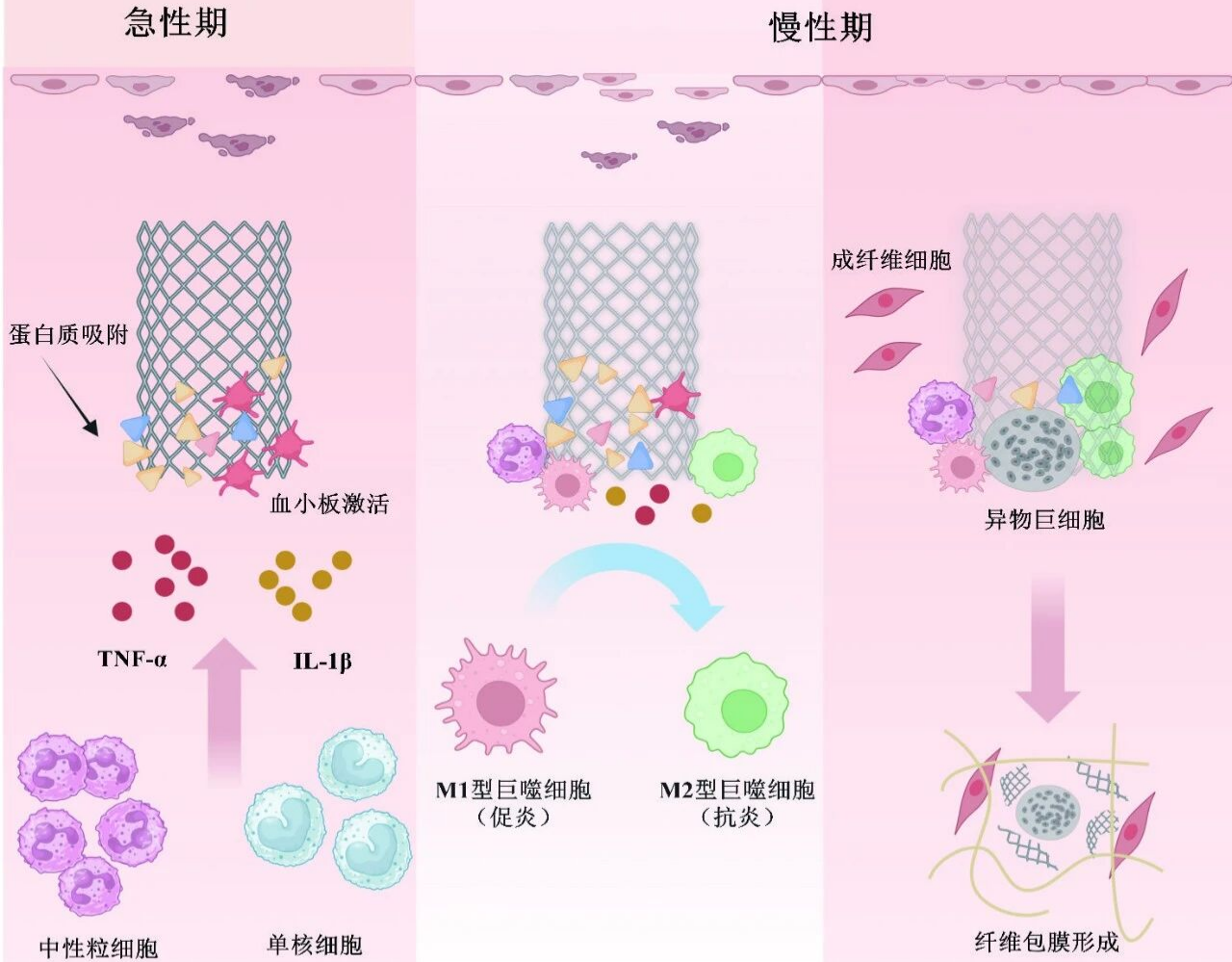 文献分享 | 可降解封堵器在生物体内的炎性反应及研究进展